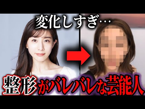 【ゆっくり解説】変形しすぎ！整形バレバレな芸能人20選